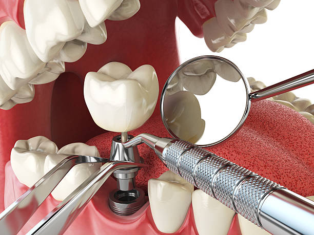 Best Cracked Tooth Emergency Dentist  in Rio Rico, AZ